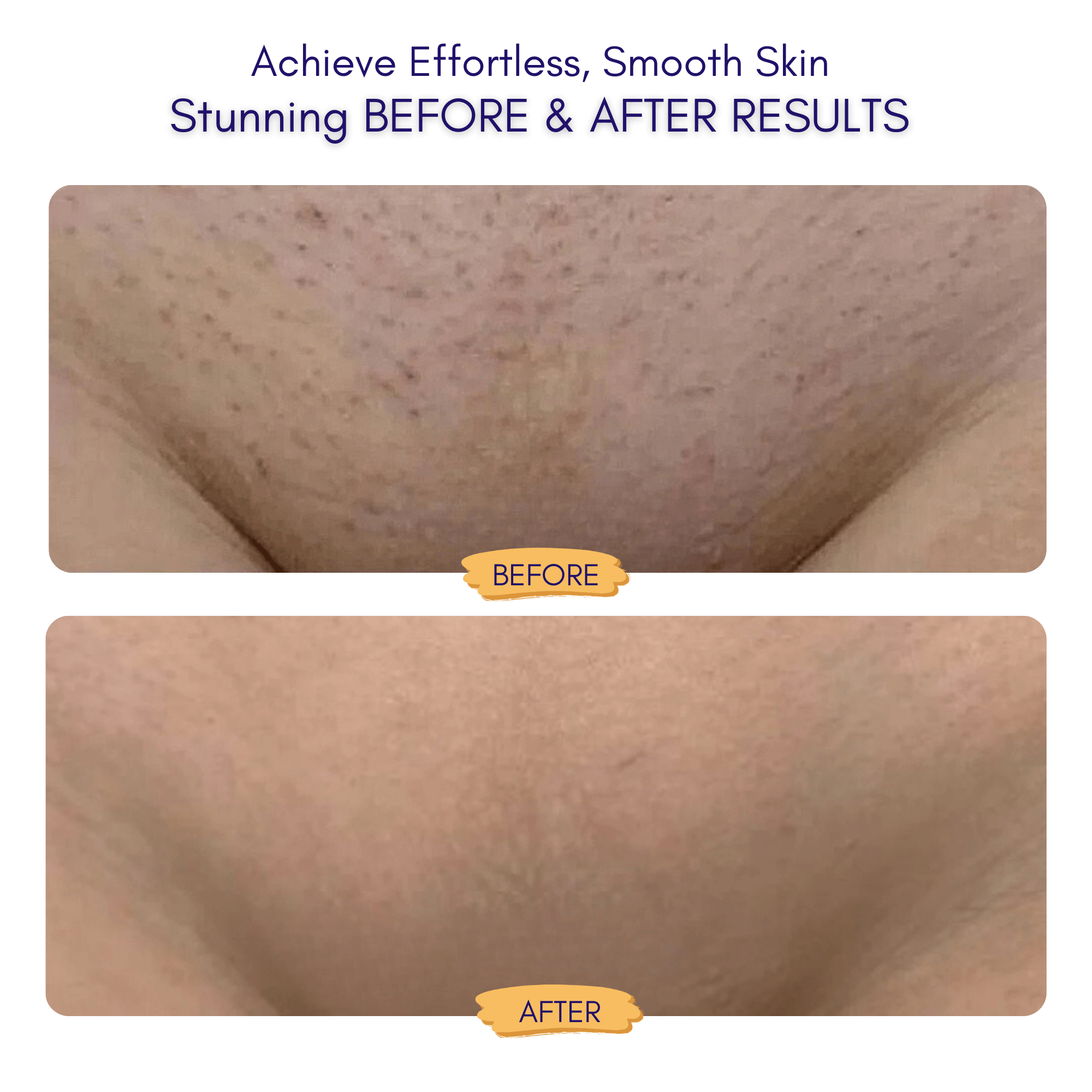 Nuvella™ Trimmer