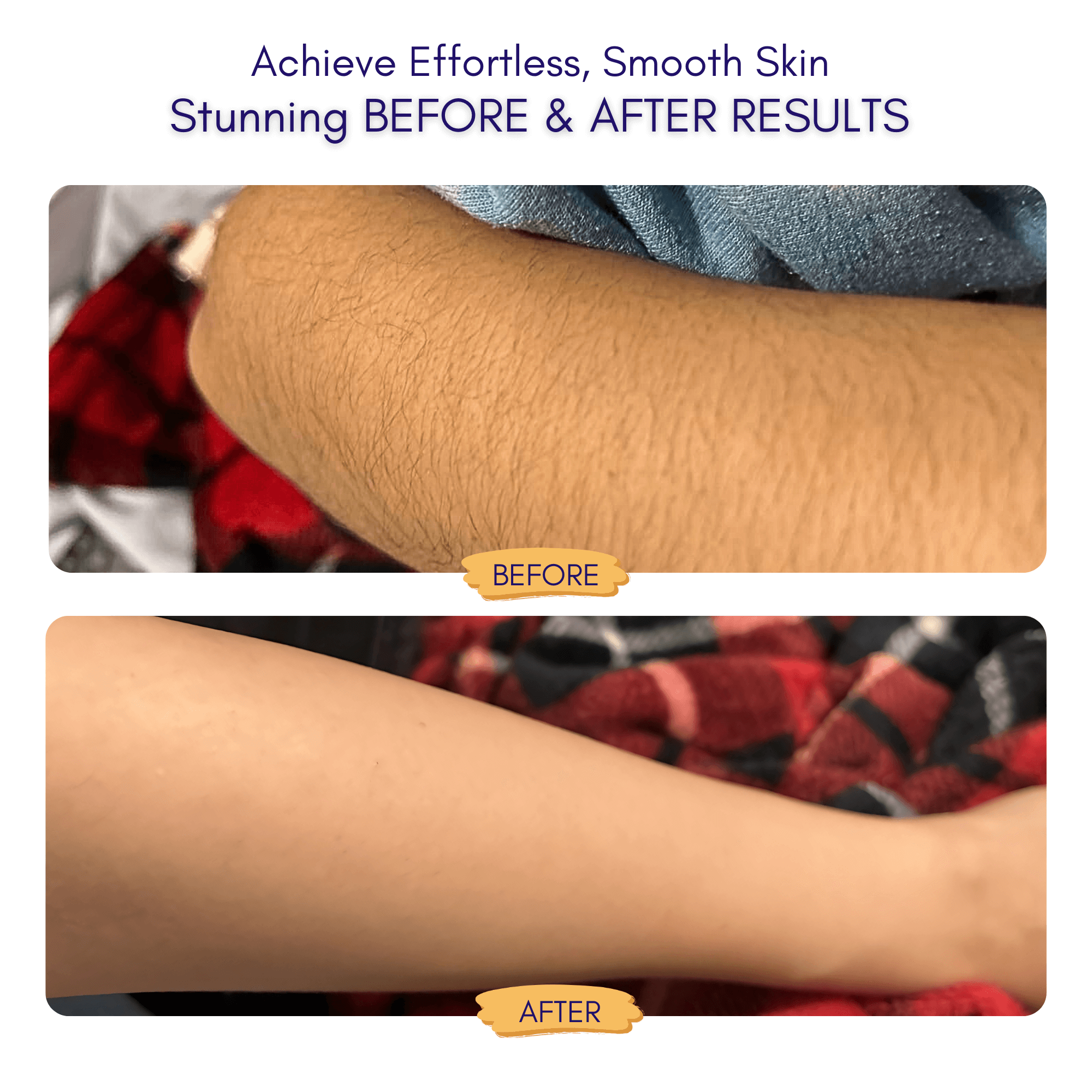 Nuvella™ Bikini Trimmer 0.2