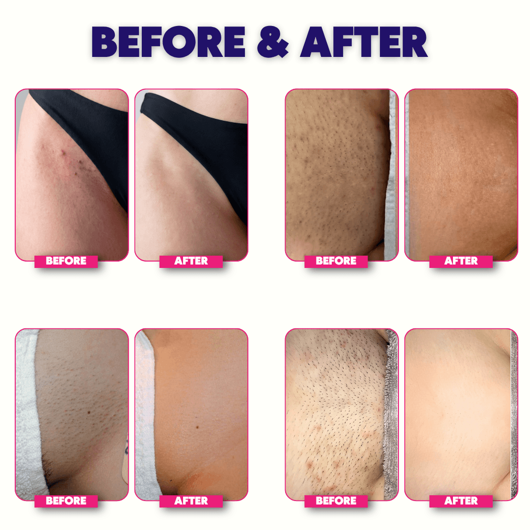 Nuvella™ Bikini Trimmer