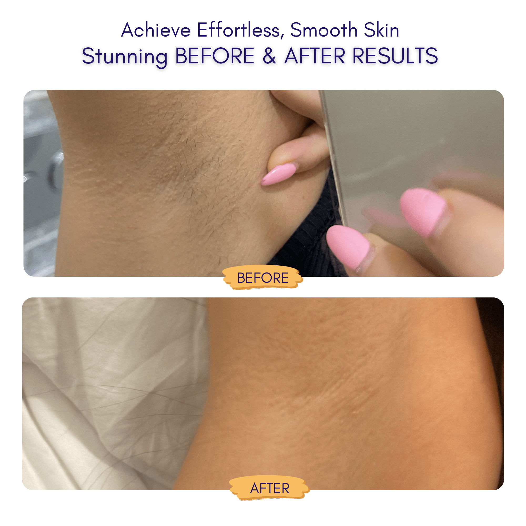 Nuvella™ Trimmer