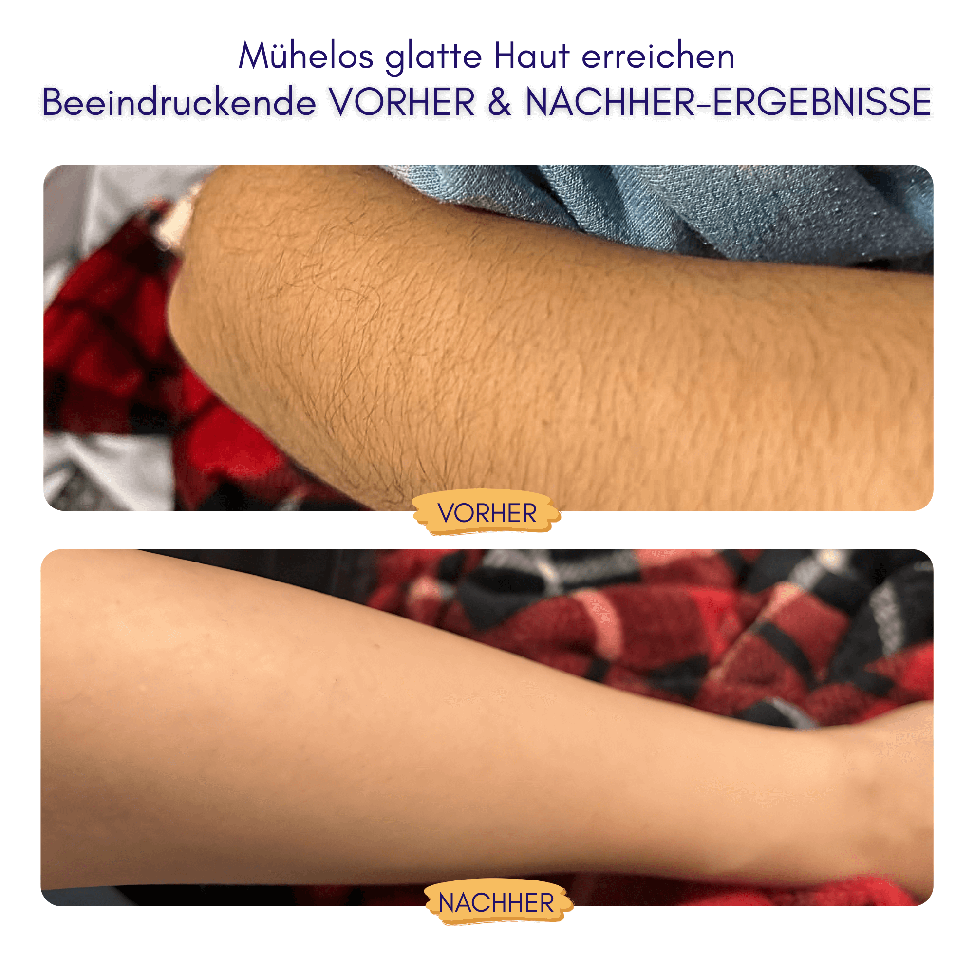 Nuvella™ Bikini Trimmer