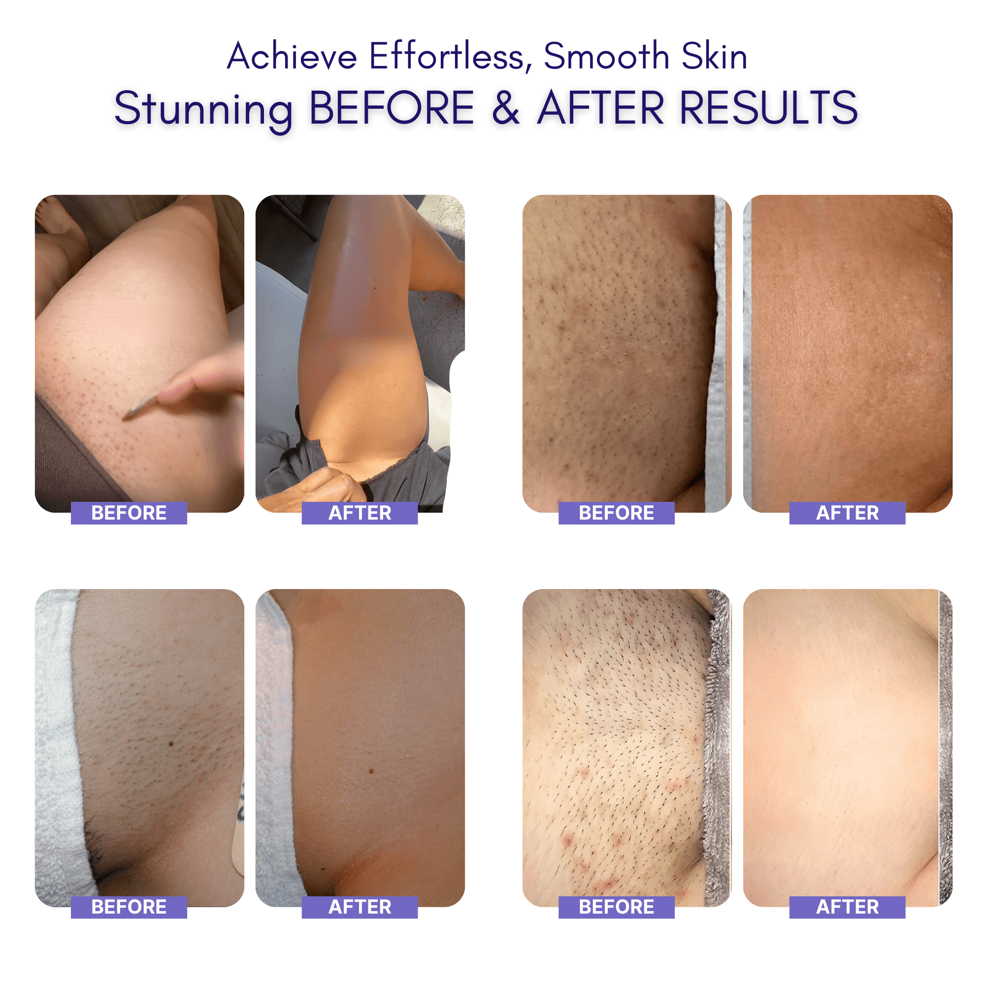 Nuvella™ Bikini Trimmer 0.1