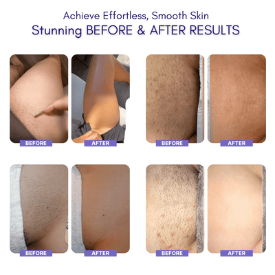 Nuvella™ Bikini Trimmer 0.1