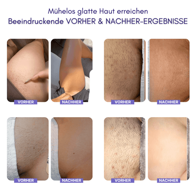 Nuvella™ Bikini Trimmer