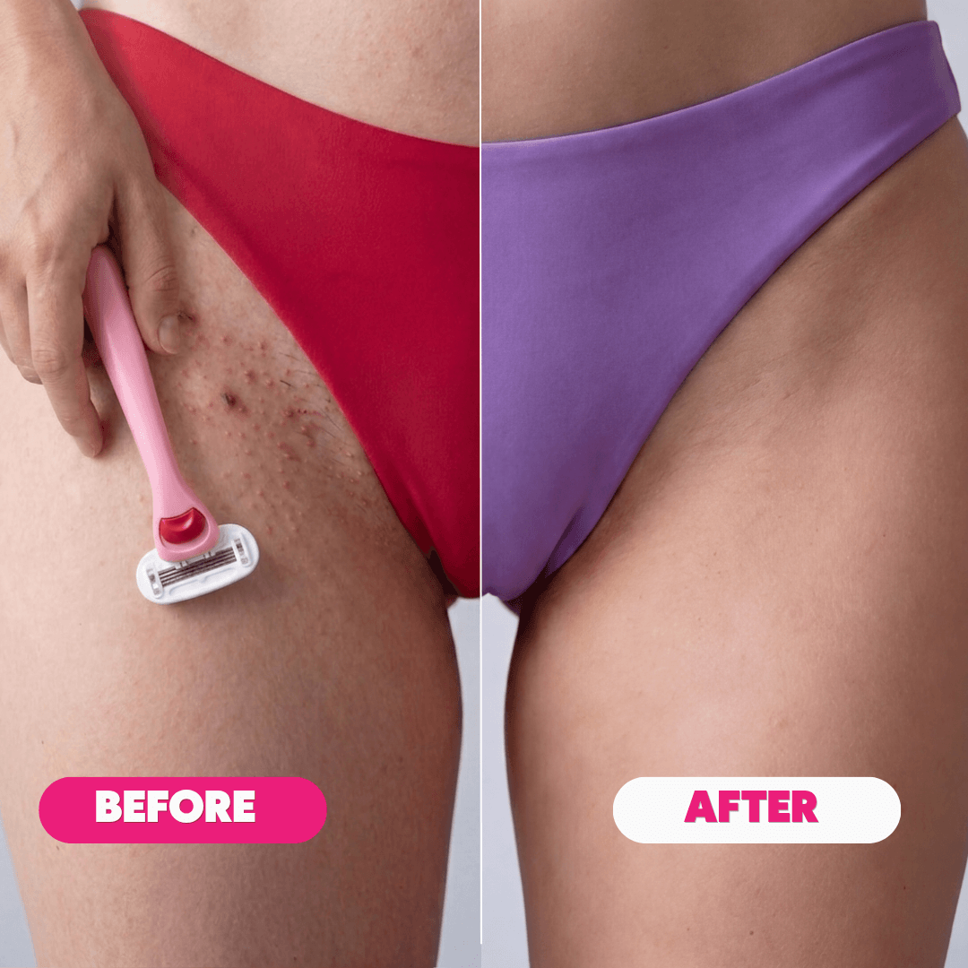 Nuvella™ Bikini Trimmer