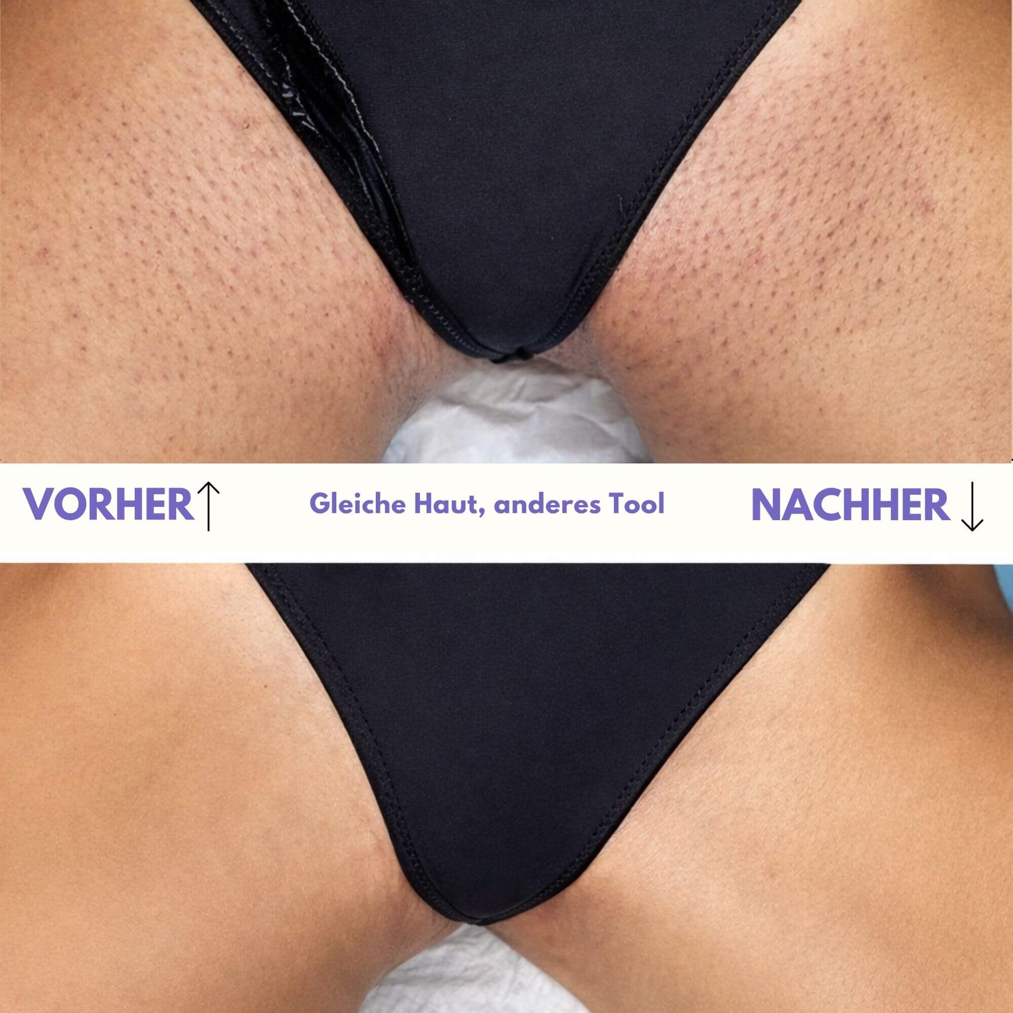 Nuvella™ Bikini Trimmer