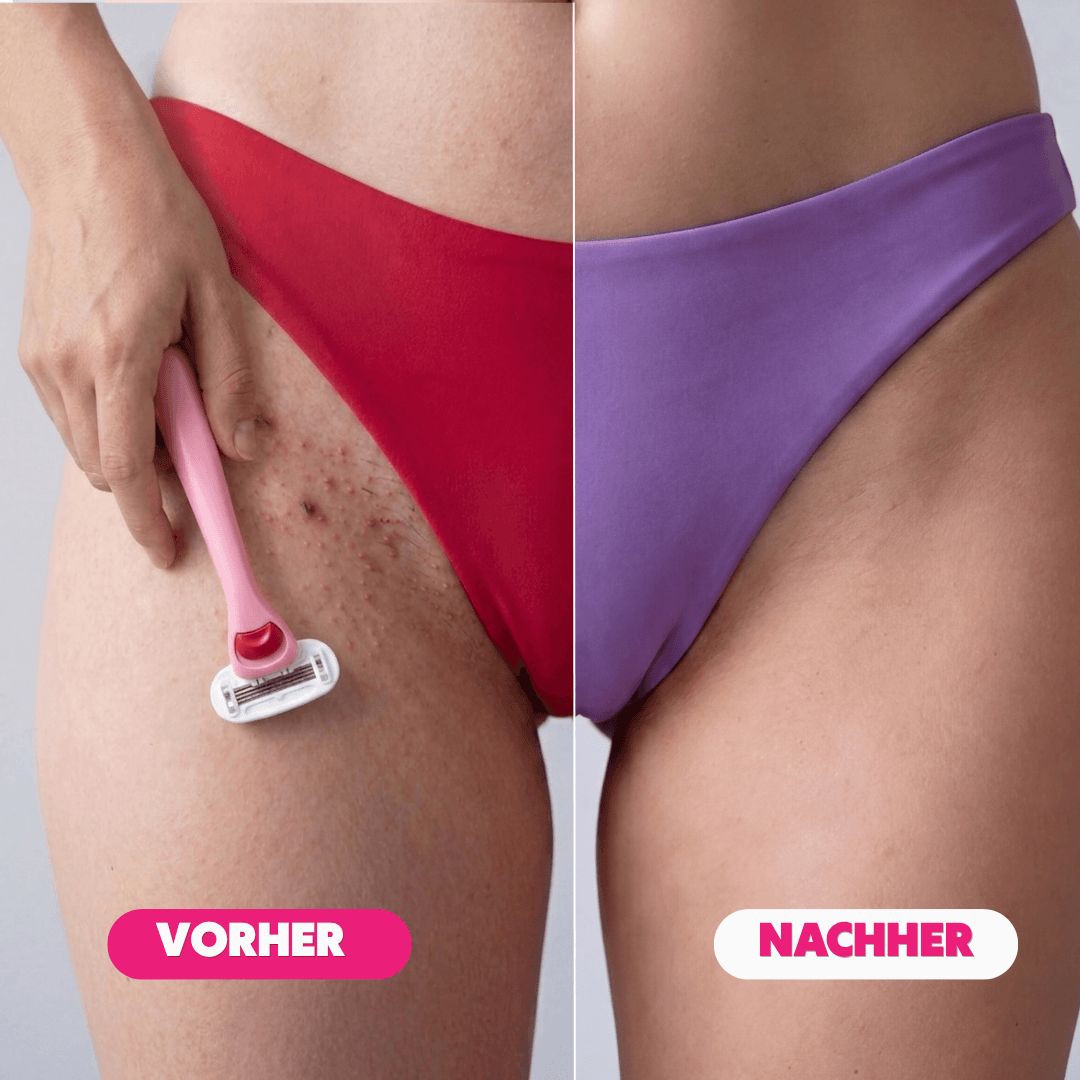 Nuvella™ Bikini Trimmer V1